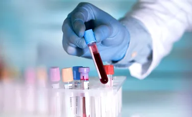 Un nou test de sânge poate depista cancerul cu trei ani înainte de diagnostic